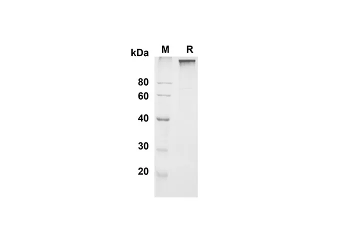 Recombinant Mouse Leptin R Protein(Fc Tag) - image 1
