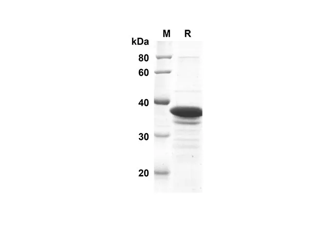 Recombinant Mouse Synapsin-1 Protein(Trx Tag) - image 1