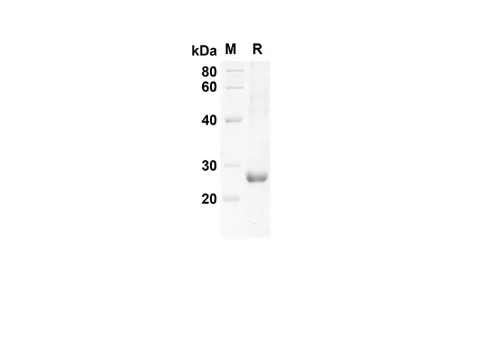 Recombinant Mouse LIX Protein(Sumo Tag) - image 1