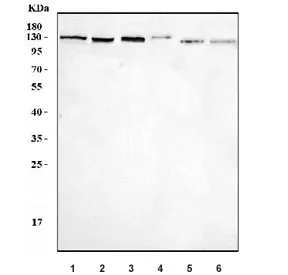 BCL11B Antibody / CTIP2 - image 1