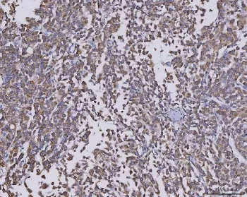 CCL14 Antibody / C-C motif chemokine 14 - image 1