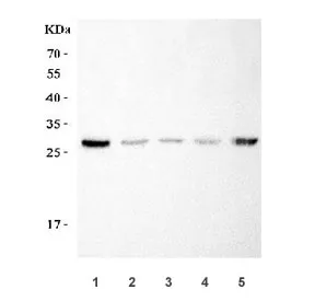 SNAIL Antibody / SNAI1 - image 1