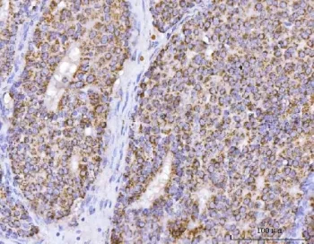 ATP5B Antibody / ATP5F1B / ATP synthase subunit beta - image 1