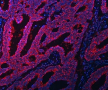 EIF3A Antibody / Eukaryotic translation initiation factor 3 subunit A - image 1