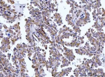 HAX1 Antibody /&nbsp;HCLS1-associated protein X-1 - image 1