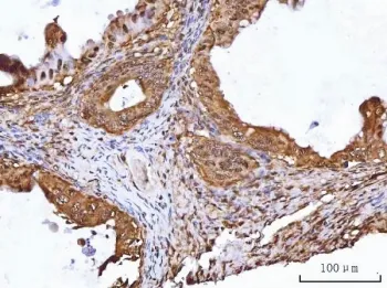 RuvB-like 1 Antibody / RUVBL1 / TIP49A - image 1