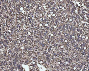 SLU7 Antibody / Pre-mRNA-splicing factor SLU7 - image 1