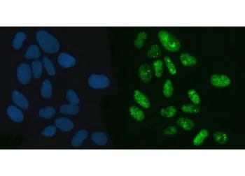 XPO5 Antibody / Exportin 5 - image 1
