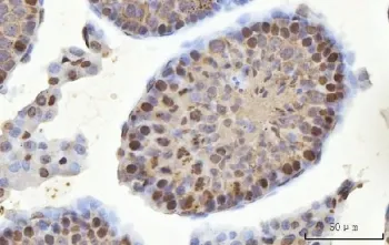 YBX2 Antibody / Y-box-binding protein 2 / MSY2 - image 1