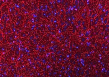 CNPase Antibody / CNP - image 1
