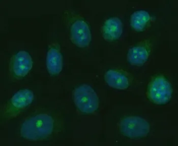 TRANK1 Antibody / TPR and ankyrin repeat-containing protein 1 - image 1