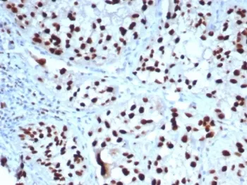 GATA3 Recombinant Antibody - image 1