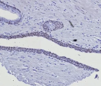 GATA3 Recombinant Antibody - image 1