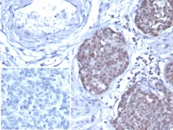 GATA3 Recombinant Antibody - image 1