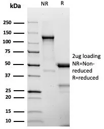CD25 Recombinant Antibody / IL2RA - image 1