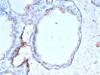 GAD65 Antibody / GAD2 - image 1