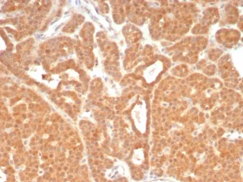 c-RET Antibody - image 1