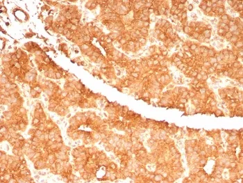 c-RET Antibody - image 1