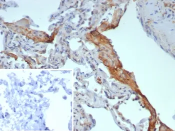 Surfactant protein D Recombinant Antibody / SFTPD - image 1