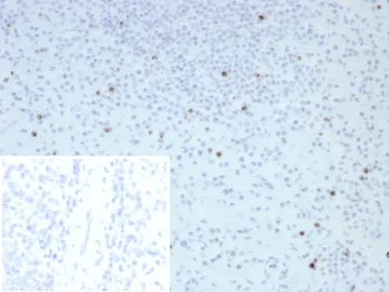 Perforin Recombinant Antibody / PRF1 - image 1