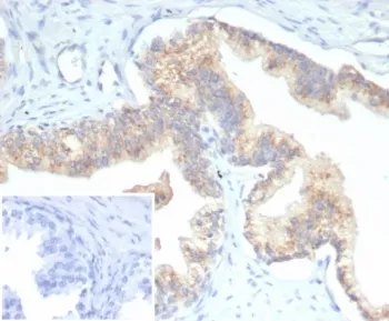 PTEN Antibody - image 1