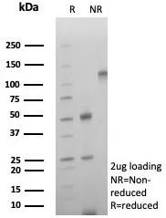 CD39 Recombinant Antibody - image 1