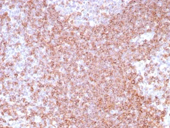 CD39 Recombinant Antibody - image 1