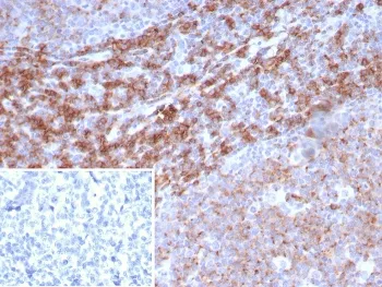 CD39 Recombinant Antibody - image 1