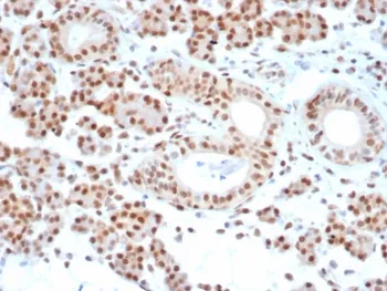 MGMT Antibody - image 1