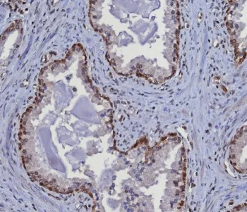 MGMT Antibody - image 1