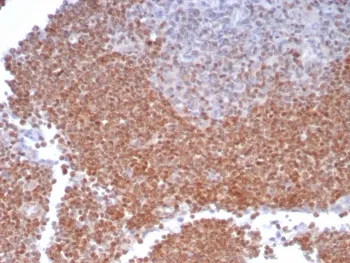 MGMT Antibody - image 1