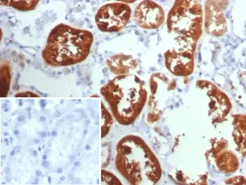 Tryptophan Hydroxylase Antibody / TPH1 - image 1