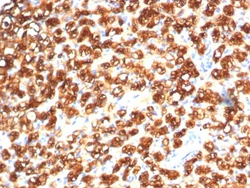 Tryptophan Hydroxylase Antibody / TPH1 - image 1