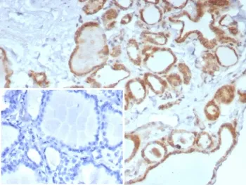 Calcitonin Recombinant Antibody / CALCA / CGRP - image 1