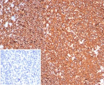 CD20 Recombinant Antibody - image 1