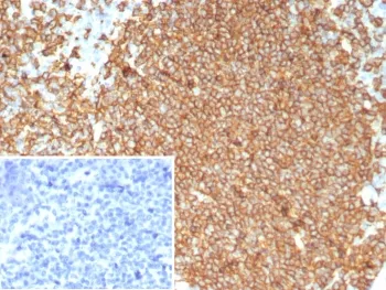 CD20 Recombinant Antibody - image 1