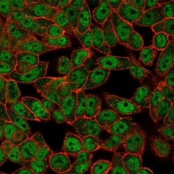 DRAP1 Antibody / NC2 alpha - image 1