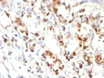 Progesterone Receptor Recombinant Antibody - image 1