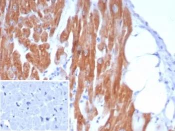 Alpha B Crystallin Antibody / CRYAB - image 1