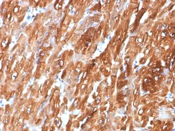 Alpha B Crystallin Antibody / CRYAB - image 1