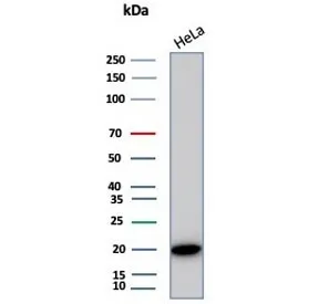 Alpha B Crystallin Antibody / CRYAB - image 1