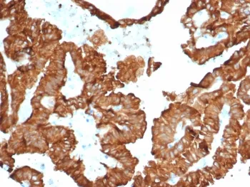 Alpha B Crystallin Antibody / CRYAB - image 1