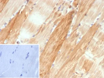 Alpha B Crystallin Antibody / CRYAB - image 1