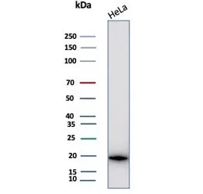 Alpha B Crystallin Antibody / CRYAB - image 1