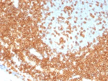 CD3 epsilon Recombinant Antibody - image 1