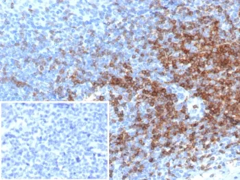 CD3 epsilon Recombinant Antibody - image 1