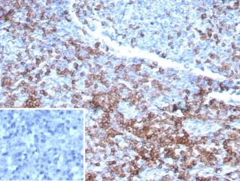 CD3 epsilon Recombinant Antibody - image 1
