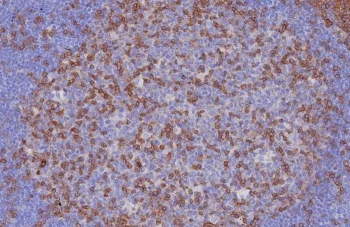 CD3 epsilon Recombinant Antibody - image 1