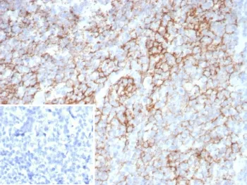 LAG3 Antibody / CD223 - image 1