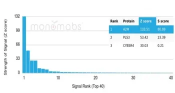 A2M Antibody / Alpha-2-Macroglobulin - image 1